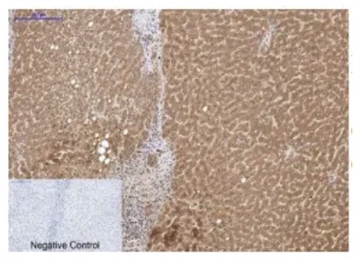 Fig.1 IHC analysis. (Creative Biolabs Original)