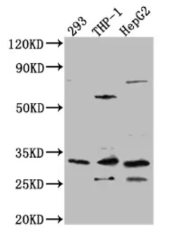 Fig.1 WB analysis. (Creative Biolabs Original)