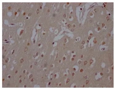 Fig.2 IHC analysis. (Creative Biolabs Original)