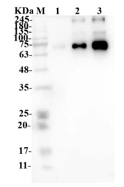 Fig.1 WB analysis. (Creative Biolabs Original)