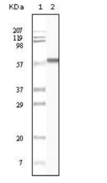 Fig.1 WB analysis. (Creative Biolabs Original)