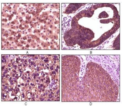 Fig.2 IHC analysis. (Creative Biolabs Original)
