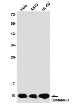 Fig.1 WB analysis. (Creative Biolabs Original)
