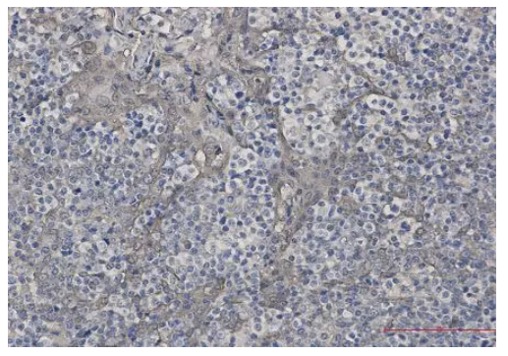 Fig.2 IHC analysis. (Creative Biolabs Original)