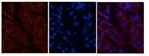 Fig.1 IF analysis. (Creative Biolabs Original)
