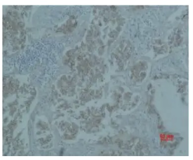 Fig.2 IHC analysis. (Creative Biolabs Original)
