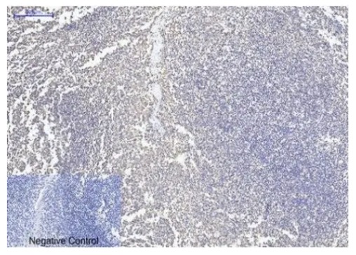 Fig.2 IHC analysis. (Creative Biolabs Original)