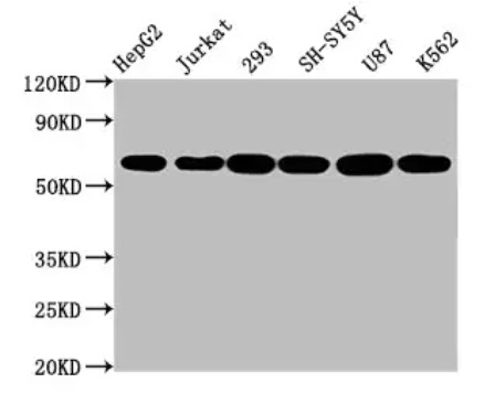 Fig.1 WB analysis. (Creative Biolabs Original)
