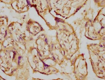 Fig.2 IHC analysis. (Creative Biolabs Original)