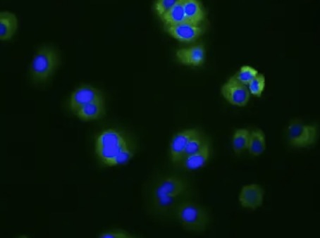 Fig.3 IF analysis. (Creative Biolabs Original)