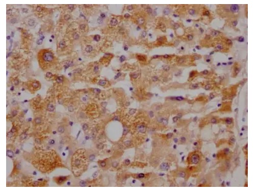 Fig.1 IHC analysis. (Creative Biolabs Original)