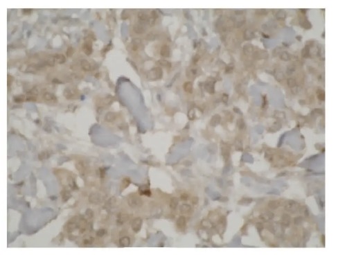 Fig.2 IHC analysis. (Creative Biolabs Original)
