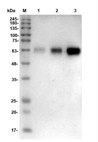Fig.4 WB analysis of TAB-176MZ. (Creative Biolabs Original)