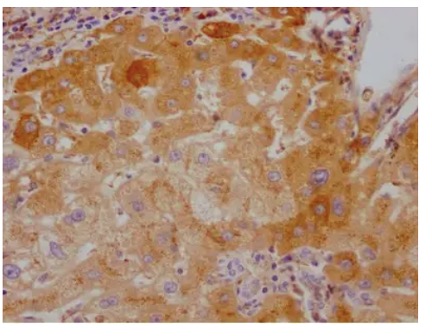 Fig.1 IHC analysis. (Creative Biolabs Original)