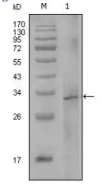 Fig.1 WB analysis. (Creative Biolabs Original)