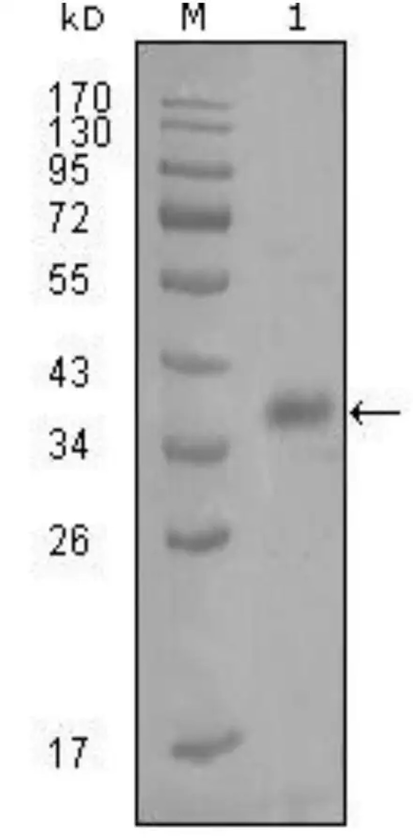 WB analysis. (Creative Biolabs Original)