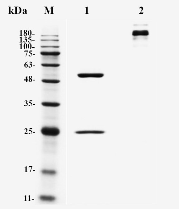 Fig.1 SDS-PAGE analysis. (Creative Biolabs Original)
