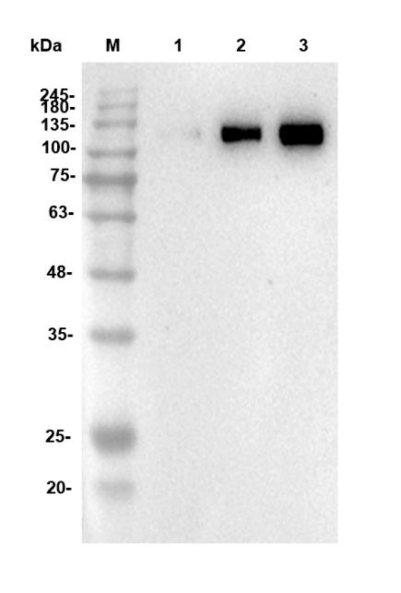 Fig.4 WB analysis. (Creative Biolabs Original)