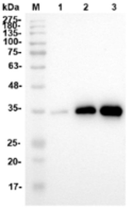 Fig.1 WB analysis. (Creative Biolabs Original)