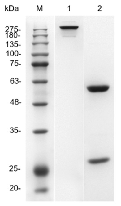 Fig.1 SDS-PAGE analysis. (Creative Biolabs Original)