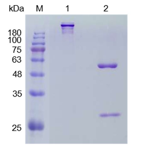 Fig.1 SDS-PAGE analysis. (Creative Biolabs Original)