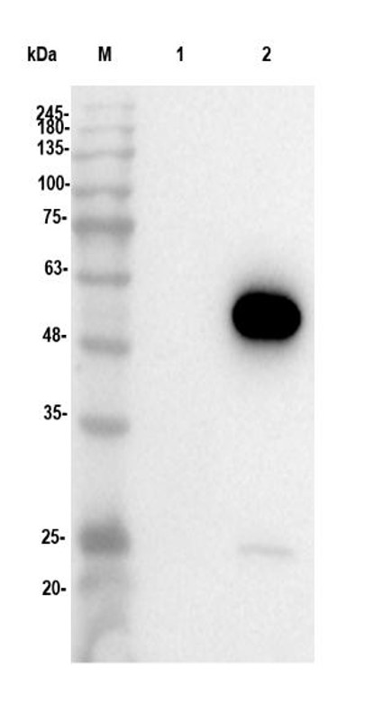 Fig.2 WB analysis. (Creative Biolabs Original)