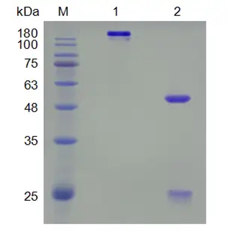 SDS-PAGE analysis. (Creative Biolabs Original)