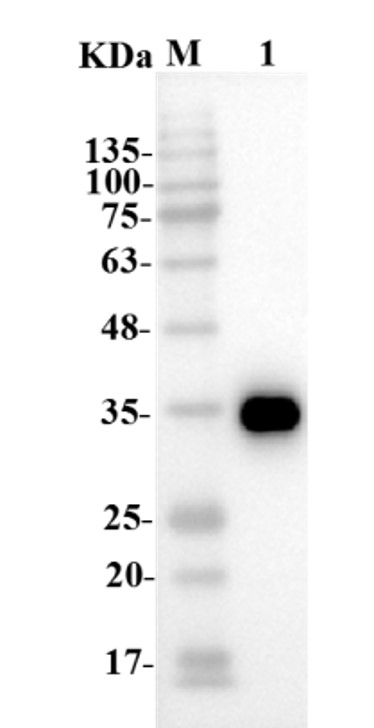 Fig.1 WB analysis. (Creative Biolabs Original)