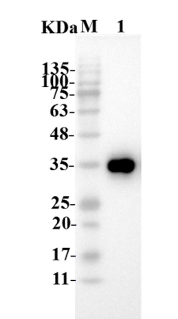 Fig.4 WB analysis. (Creative Biolabs Original)