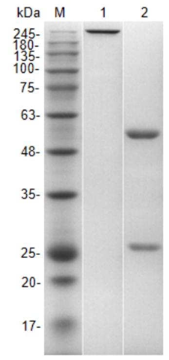 Fig.5 SDS-PAGE analysis. (Creative Biolabs Original)