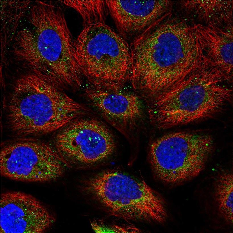 IF analysis. (Creative Biolabs Original)