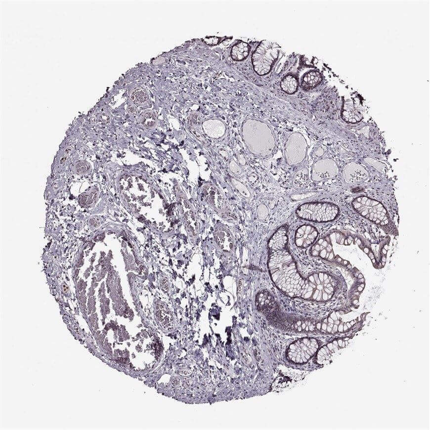 IHC analysis. (Creative Biolabs Original)