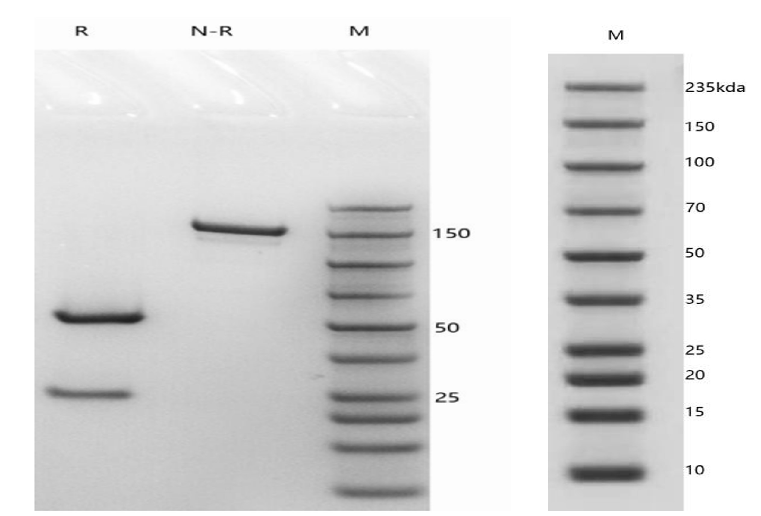 Fig.2 SDS-PAGE analysis. (Creative Biolabs Original)