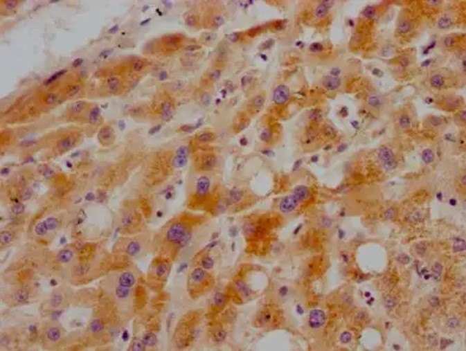 Fig.2 IHC analysis. (Creative Biolabs Original)