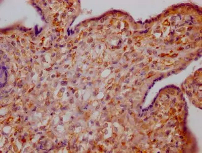 Fig.3 IHC analysis. (Creative Biolabs Original)
