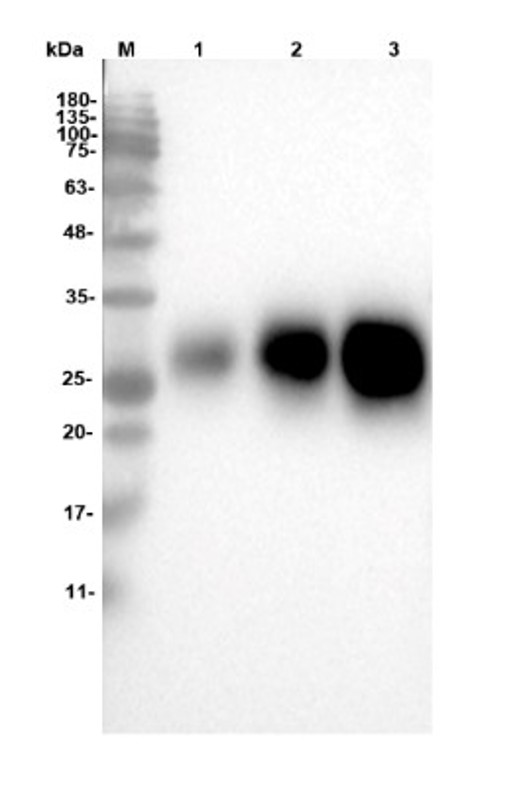Fig.1 WB analysis. (Creative Biolabs Original)