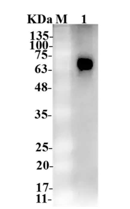 Fig.4 WB analysis. (Creative Biolabs Original)