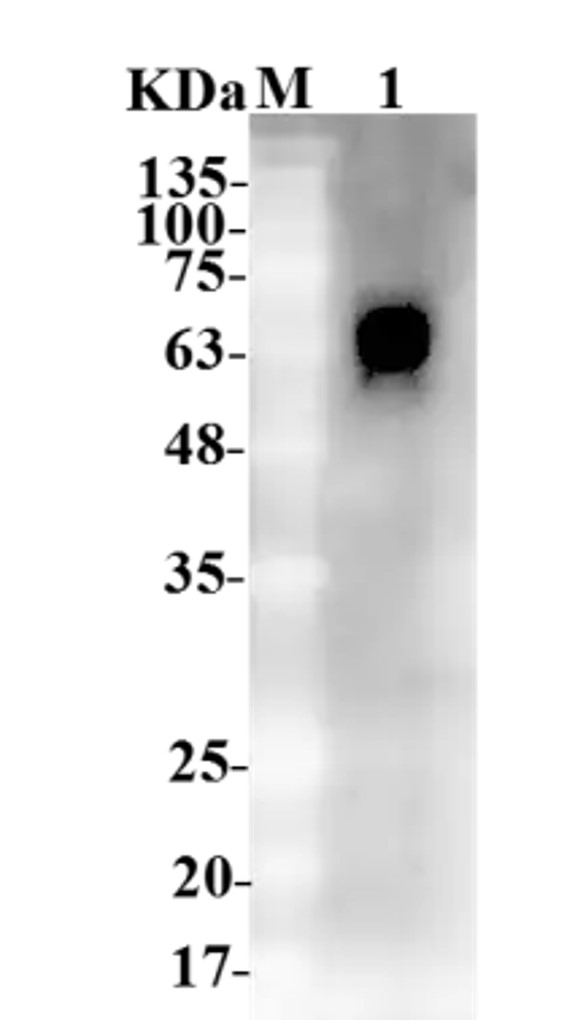 Fig.5 WB analysis. (Creative Biolabs Original)