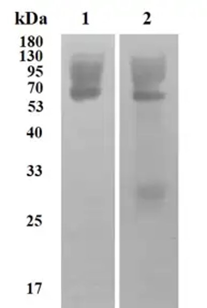 Fig.1 WB analysis. (Creative Biolabs Original)