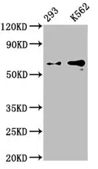 Fig.3 WB analysis. (Creative Biolabs Original)