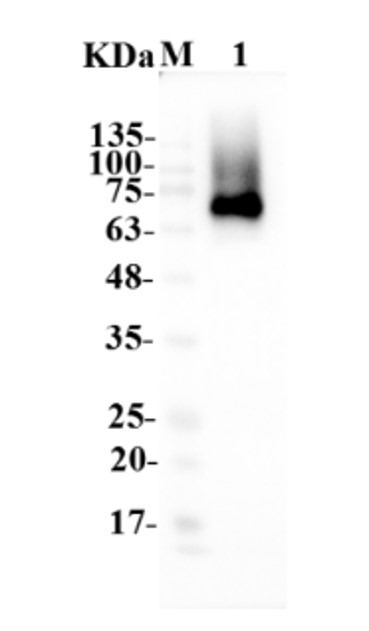 Fig.5 WB analysis. (Creative Biolabs Original)