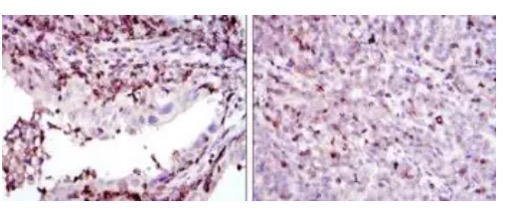 Fig.1 IHC analysis. (Creative Biolabs Original)