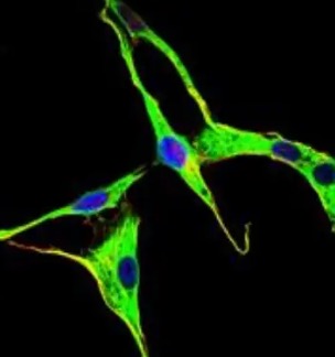 Fig.2 IF analysis. (Creative Biolabs Original)