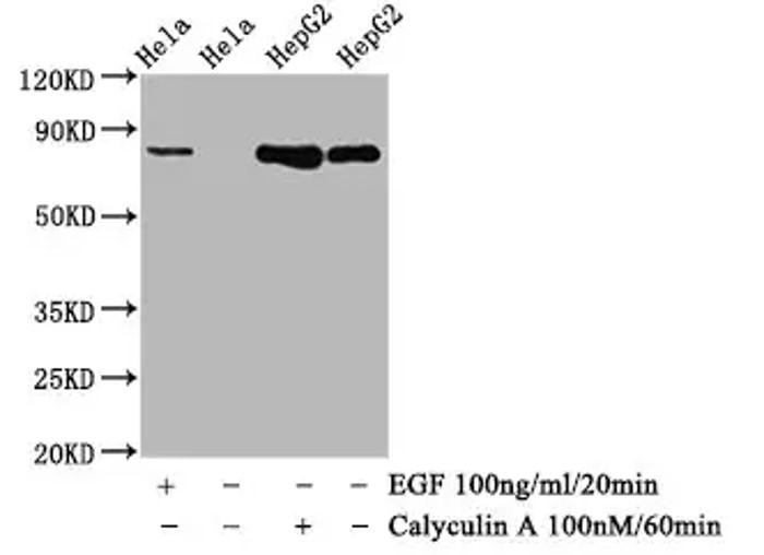 Fig.3 WB analysis. (Creative Biolabs Original)