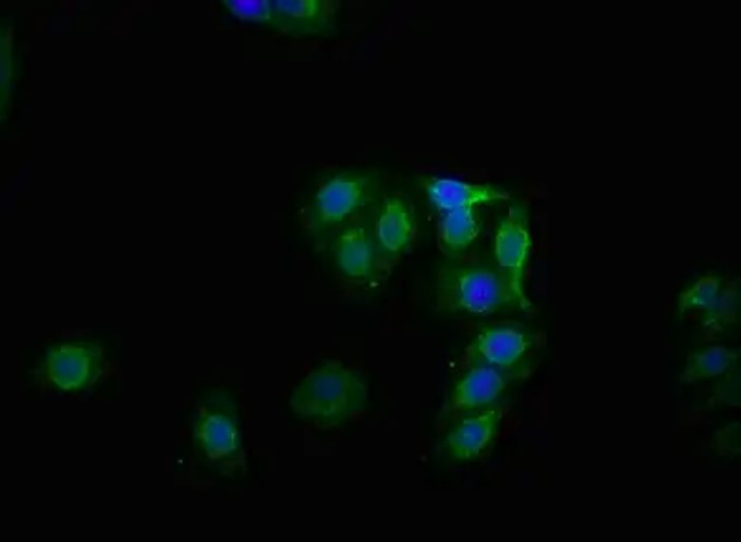 Fig.4 IF analysis. (Creative Biolabs Original)