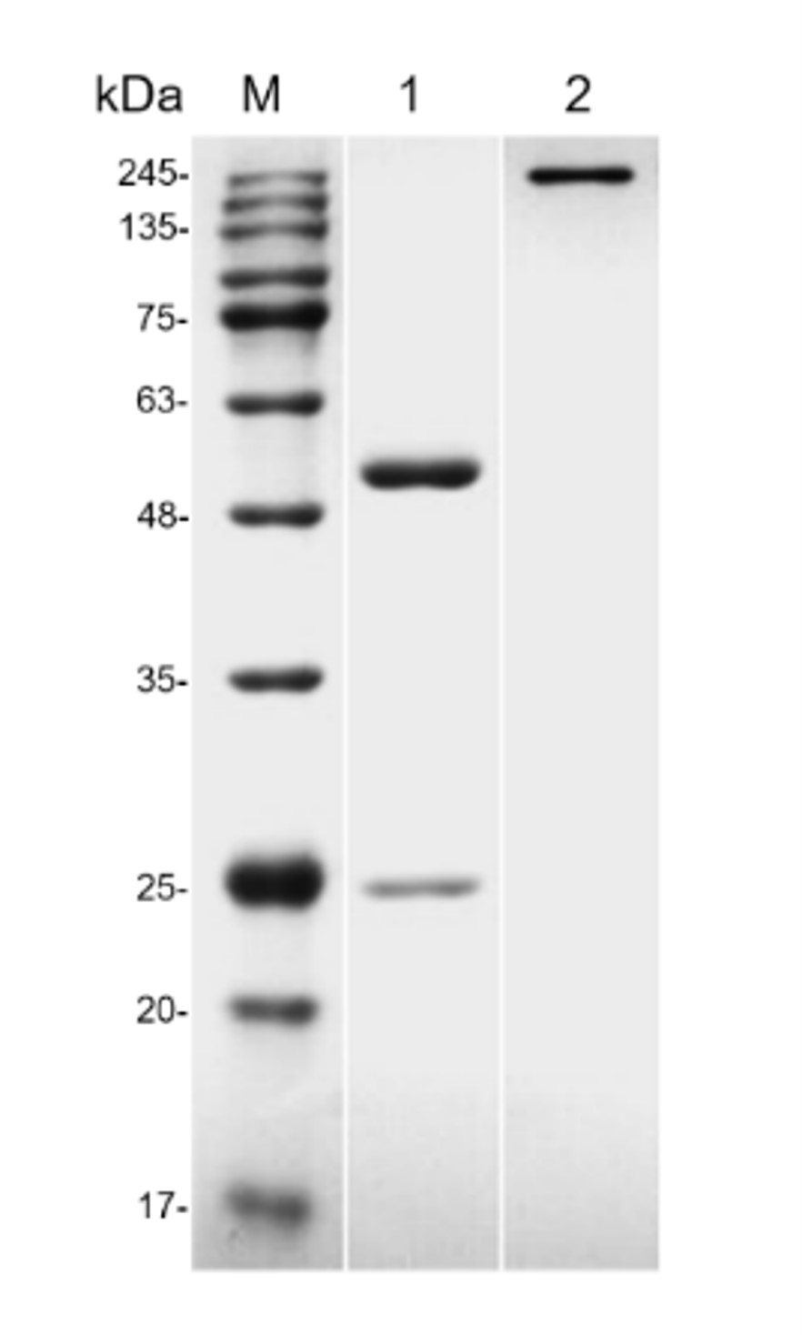 Fig.1 SDS-PAGE analysis. (Creative Biolabs Original)