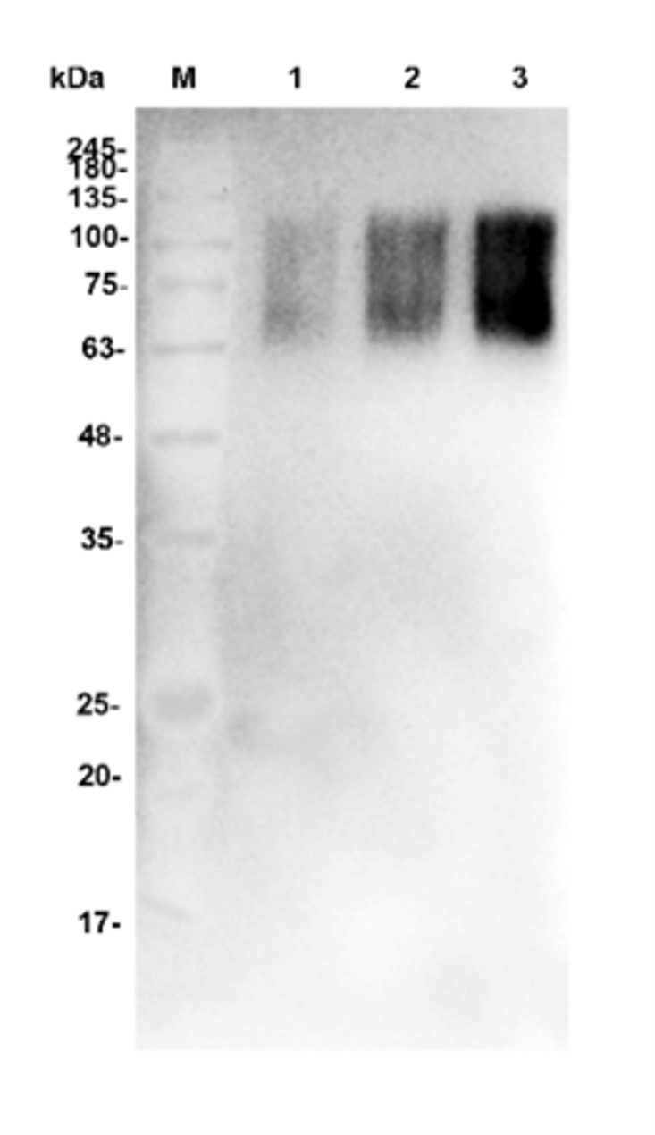 Fig.4 WB analysis. (Creative Biolabs Original)