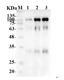 Fig.3 WB analysis. (Creative Biolabs Original)