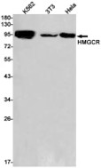 Fig.1 WB analysis of anti-HMGCR antibody. (Creative Biolabs Original)
