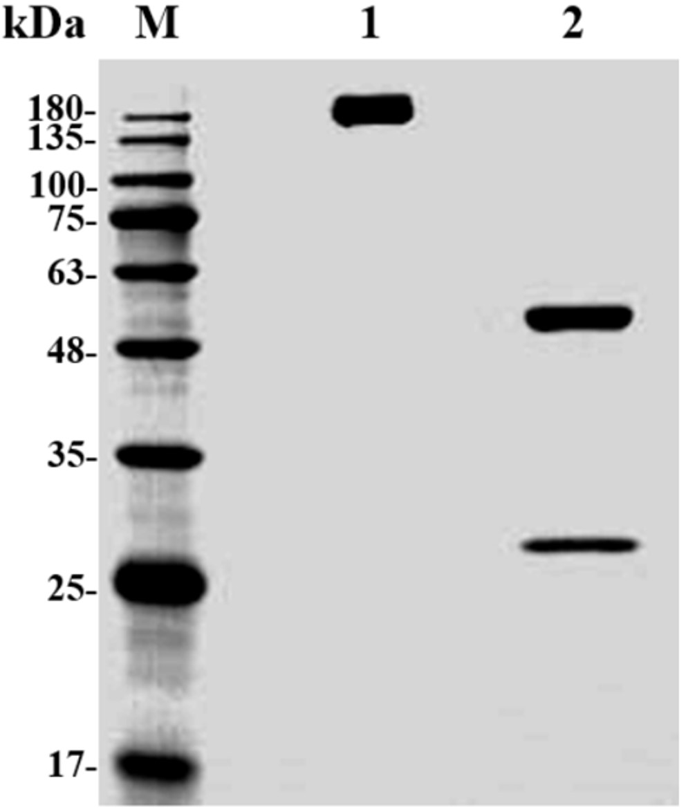 Fig.1 SDS-PAGE analysis. (Creative Biolabs Original)
